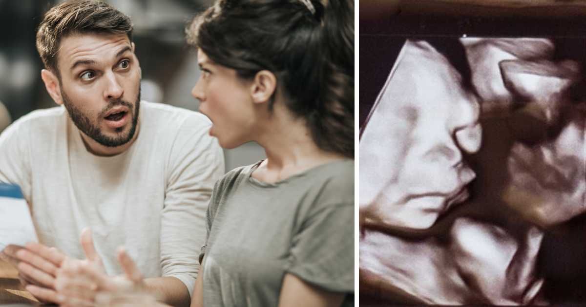 Expecting couple checked their sonogram and did a double take — their dog was staring back at them