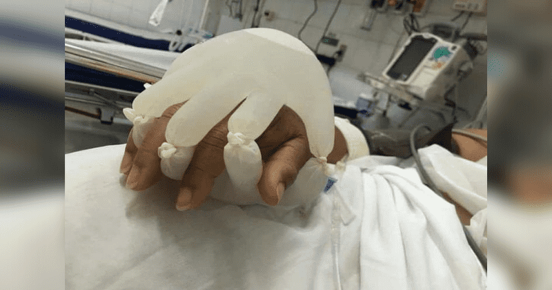 Nurse finds novel way to comfort isolated coronavirus patient with warm rubber glove 'hands'