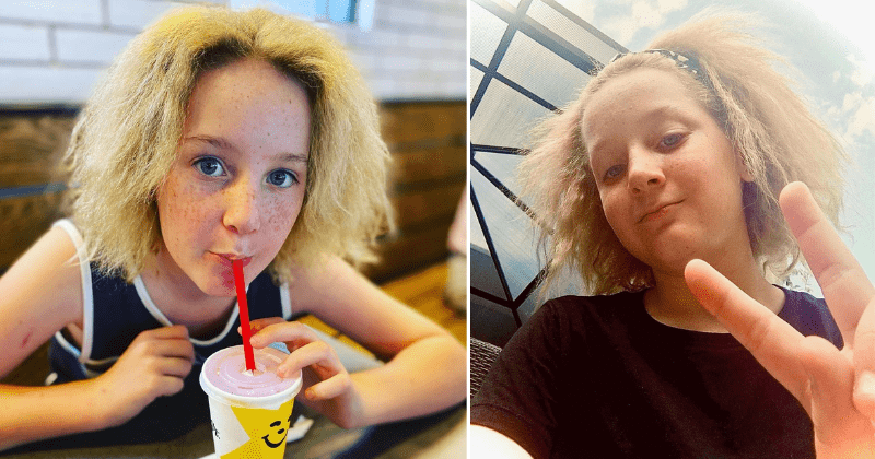 Girl with 'uncombable hair syndrome' rocks it in style: 'I look like a lion with a crazy mane'