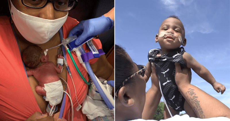 Alabama baby was born at 21 weeks and had a 1% chance of survival. Today, he's the world’s most premature infant to survive.