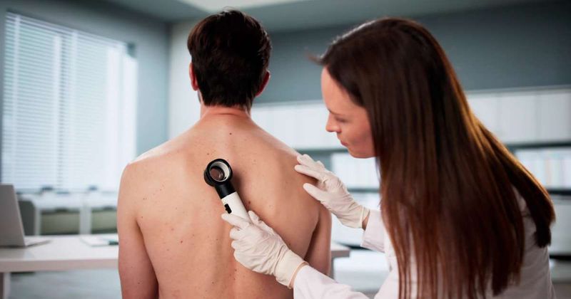 Wife circled husband's moles for dermatologist appointment. His doctor responded by rating each mole