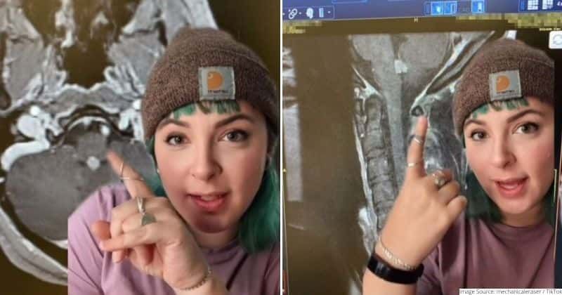 Woman with brain tumor unable to access ICU bed amid rising COVID cases, asks everyone to get vaccine