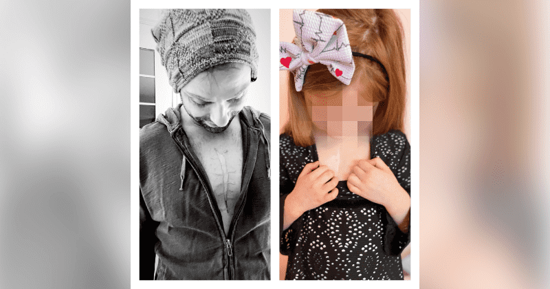 Dad gets tattoo to match 4-year-old daughter's heart surgery scar so she doesn't feel alone 