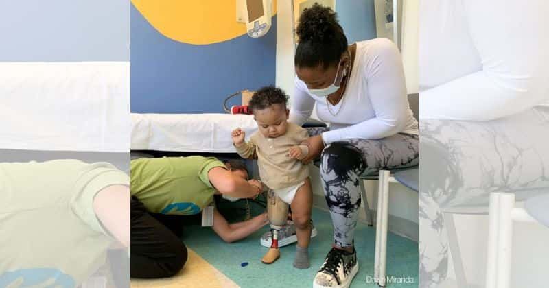 Boy born with a rare condition just took his first steps with a prosthetic leg.
