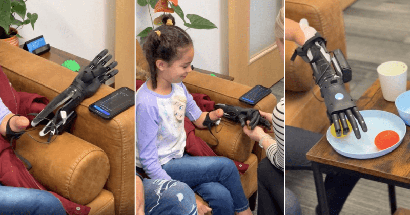 Little girl's reaction to trying bionic arm for the first time melts hearts: 'She feels special'