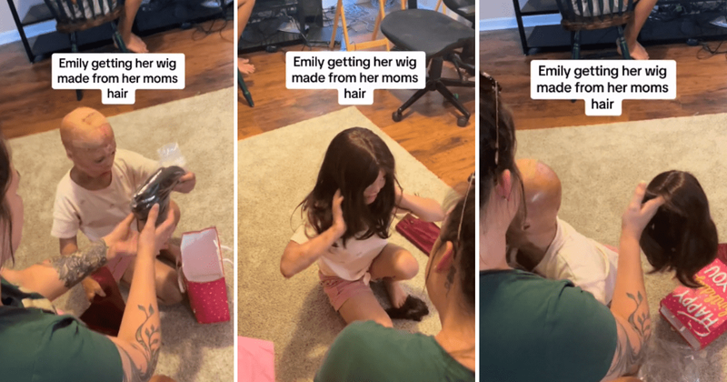 Little girl who survived 3rd-degree burns hugs her mom after receiving a wig for her birthday
