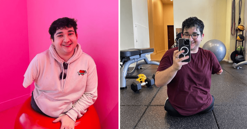 Man born with a single limb lives an independent life and inspires people to celebrate differences