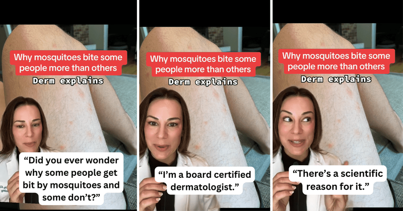 Dermatologist explains the main reason why some people are more attractive to mosquitoes than others