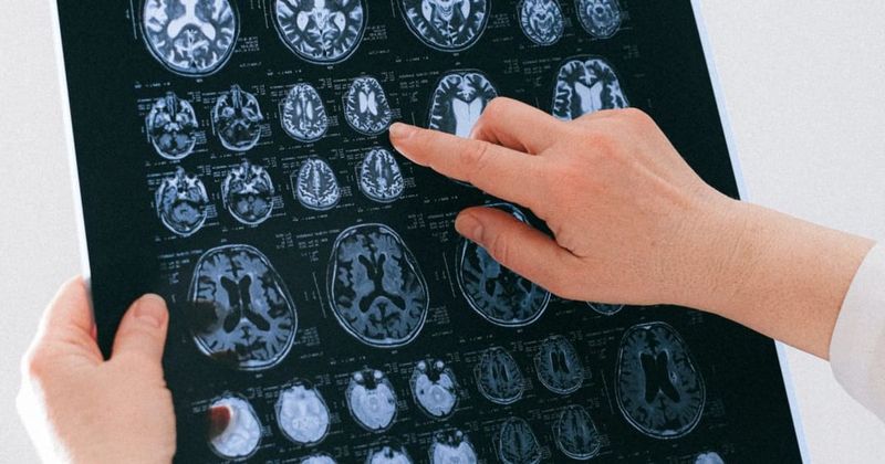 Archaeologists discover 230,000-year-old remains of the brain of extinct human species