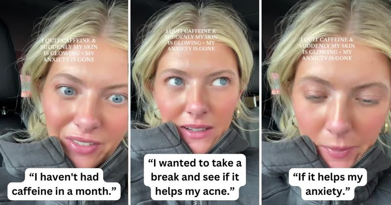 Gen Z woman shares small lifestyle change that helped her manage anxiety and acne