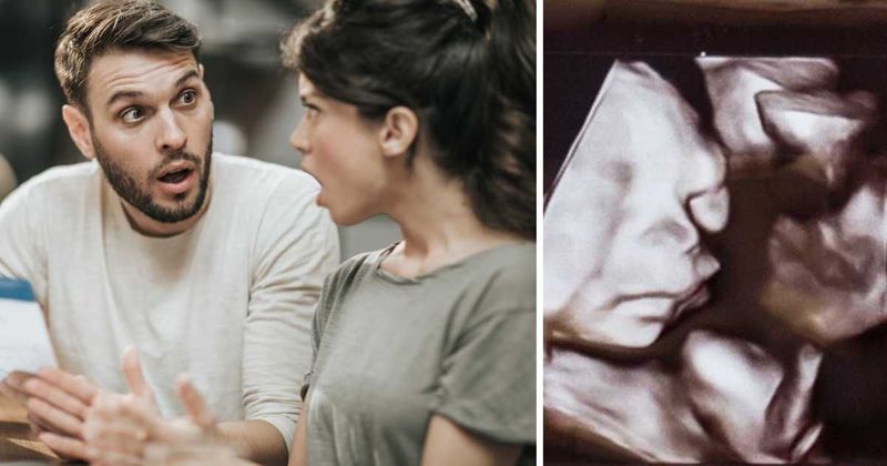 Expecting couple checked their sonogram and did a double take — their dog was staring back at them