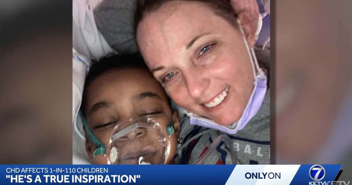 4-year-old walks into the hospital alone for a heart surgery, leaves with a new mom — the doctor 