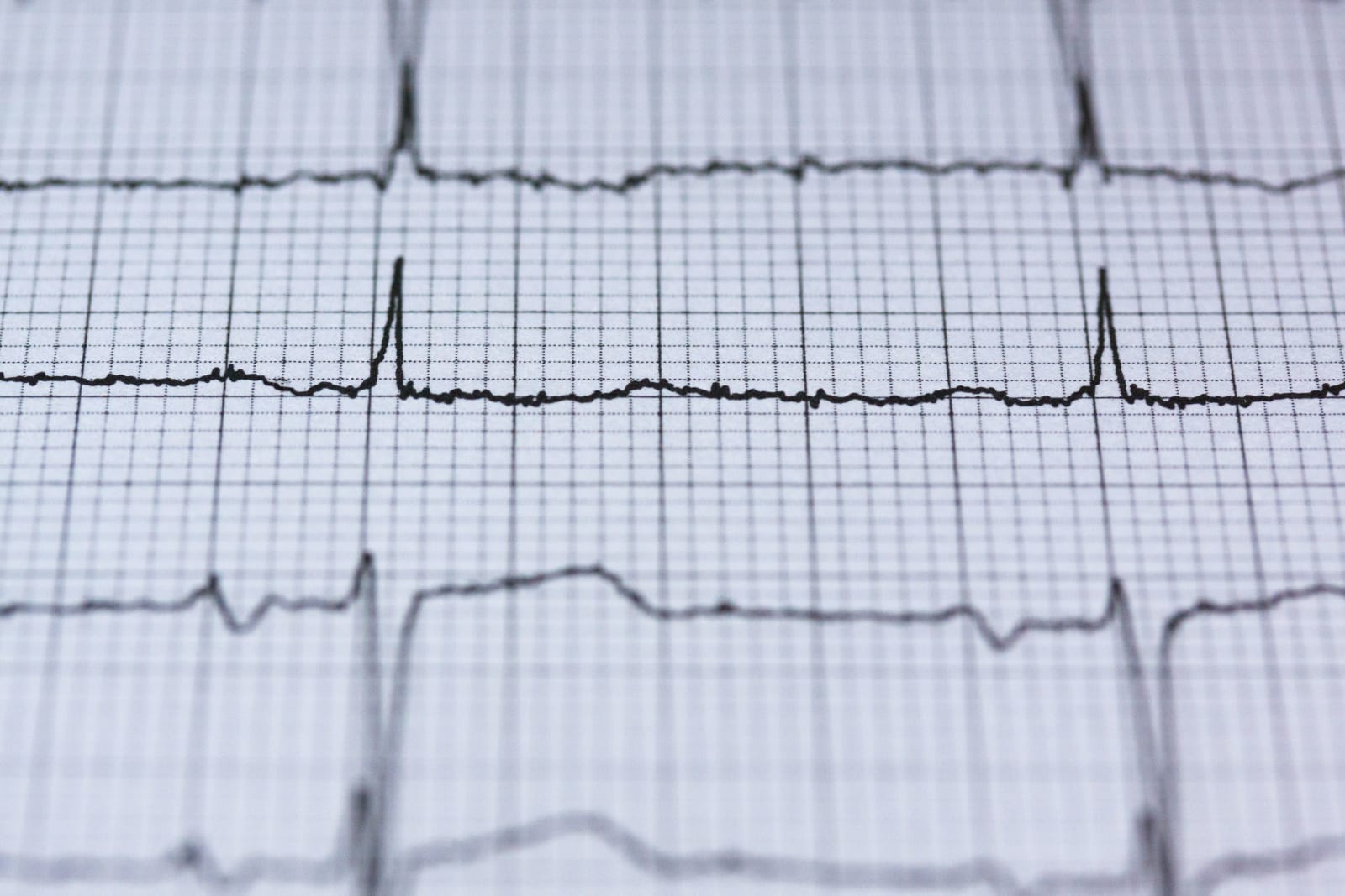 Sound waves on paper. (Representative Cover Image Source: Pexels | Photo by Pixabay)